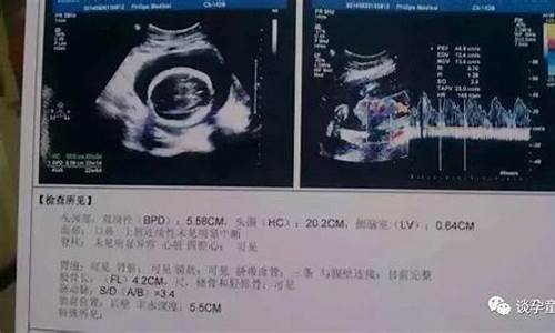 电脑b超单怎么做-电脑系统b超怎么调整